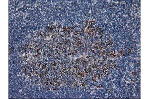 Image no. 4 for anti-Dihydrolipoamide Dehydrogenase (DLD) antibody (ABIN1497846) (DLD anticorps)