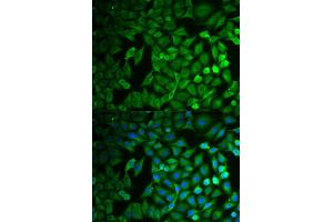 Immunofluorescence (IF) image for anti-F-Box Protein 11 (FBXO11) antibody (ABIN1877139)