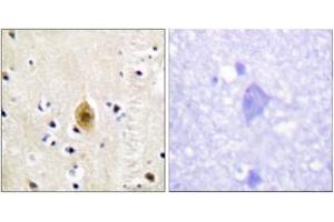 Immunohistochemistry analysis of paraffin-embedded human brain, using Mst1/2 (Phospho-Thr183) Antibody. (MST1/MST2 (AA 149-198), (pThr183) anticorps)