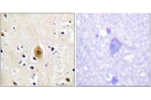 Immunohistochemistry analysis of paraffin-embedded human brain, using Mst1/2 (Phospho-Thr183) Antibody. (MST1/MST2 (AA 149-198), (pThr183) anticorps)