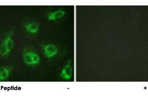 Immunofluorescence analysis of HeLa cells, using KCNIP3 polyclonal antibody . (DREAM anticorps)