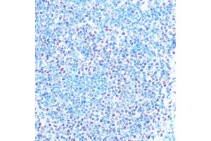 Immunohistochemistry of paraffin-embedded mouse spleen using SNRPB Rabbit pAb (ABIN6134519, ABIN6148214, ABIN6148215 and ABIN6219175) at dilution of 1:100 (40x lens). (SNRPB anticorps  (AA 1-100))