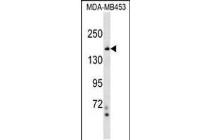 Western blot analysis in MDA-MB453 cell line lysates (35ug/lane). (NFKBIL2 anticorps  (N-Term))