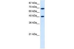 WB Suggested Anti-RRP9 Antibody Titration:  5. (RRP9 anticorps  (Middle Region))