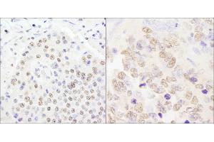 Immunohistochemistry (IHC) image for anti-Cleavage and Polyadenylation Specific Factor 2, 100kDa (CPSF2) (AA 450-500) antibody (ABIN7453679)
