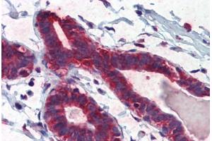 Human Breast (formalin-fixed, paraffin-embedded) stained with TBX5 antibody ABIN462189 followed by biotinylated goat anti-rabbit IgG secondary antibody ABIN481713, alkaline phosphatase-streptavidin and chromogen.