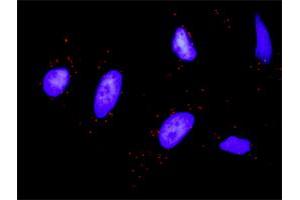 Proximity Ligation Analysis of protein-protein interactions between STAT1 and KIT.