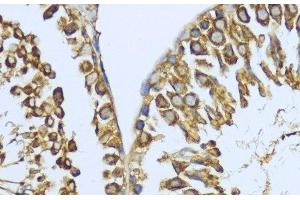 Immunohistochemistry of paraffin-embedded Rat testis using HSP90AA1 Polyclonal Antibody at dilution of 1:200 (40x lens).