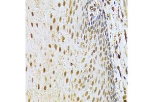 Immunohistochemistry of paraffin-embedded human esophagus using CDK4 Antibody.