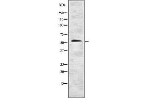 Western blot analysis of CLK4 using COLO205 whole cell lysates (CLK4 anticorps  (Internal Region))