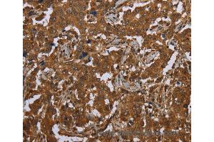 Immunohistochemistry of Human brain  using SCGB1D2 Polyclonal Antibody at dilution of 1:40 (SCGB1D2 anticorps)