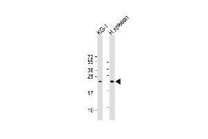 All lanes : Anti- LIF Antibody (Center) at 1:1000 dilution Lane 1: KG-1 whole cell lysate Lane 2:Human spleen whole cell lysate Lysates/proteins at 20 μg per lane. (LIF anticorps  (AA 72-101))