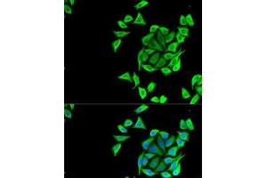 Immunofluorescence analysis of U2OS cells using KCNN3 Polyclonal Antibody (KCNN3 anticorps)