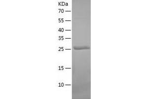 Western Blotting (WB) image for Non-SMC Element 1 Homolog (NSMCE1) (AA 1-266) protein (His-IF2DI Tag) (ABIN7124192)