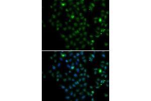 Immunofluorescence analysis of MCF7 cell using LMO4 antibody. (LMO4 anticorps)