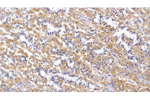 Detection of MMP2 in Human Stomach Tissue using Polyclonal Antibody to Matrix Metalloproteinase 2 (MMP2)