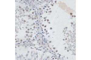 Immunohistochemistry of paraffin-embedded rat testis using USP7/HAUSP antibody (ABIN6132280, ABIN6150032, ABIN6150034 and ABIN6217614) at dilution of 1:100 (40x lens). (USP7 anticorps  (AA 206-1102))