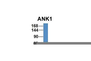 Host:  Rabbit  Target Name:  ANK1  Sample Type:  Human Fetal Liver  Antibody Dilution:  1. (Erythrocyte Ankyrin anticorps  (Middle Region))
