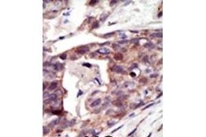 Image no. 2 for anti-Palmitoyl-Protein Thioesterase 1 (PPT1) (N-Term) antibody (ABIN357783)