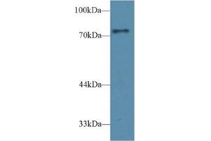 Detection of CD2AP in Rat Cerebrum lysate using Polyclonal Antibody to CD2 Associated Protein (CD2AP) (CD2AP anticorps  (AA 368-623))