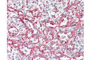 Anti-ITGA2B / CD41 antibody IHC staining of human spleen.