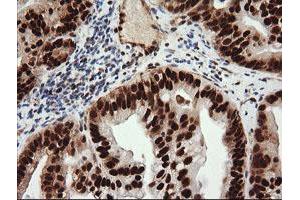 Image no. 8 for anti-Tripartite Motif Containing 38 (TRIM38) (AA 1-265) antibody (ABIN1490681) (TRIM38 anticorps  (AA 1-265))