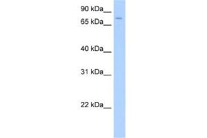 WB Suggested Anti-SV2A Antibody Titration:  0. (SV2A anticorps  (Middle Region))
