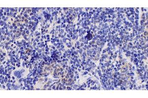 Detection of IL10 in Mouse Spleen Tissue using Monoclonal Antibody to Interleukin 10 (IL10)