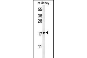 Western blot analysis of LYPD1 Antibody (C-term) (ABIN653701 and ABIN2843019) in mouse kidney tissue lysates (35 μg/lane). (LYPD1 anticorps  (C-Term))