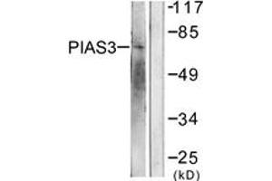 Western blot analysis of extracts from 293 cells, treated with UV 5', using PIAS3 Antibody. (PIAS3 anticorps  (AA 10-59))