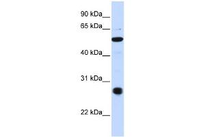 WB Suggested Anti-C6orf113 Antibody Titration:  0. (ZUFSP anticorps  (C-Term))