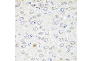 Immunohistochemistry of paraffin-embedded rat brain using G antibody (ABIN6129967, ABIN6140880, ABIN6140881 and ABIN6223736) at dilution of 1:200 (40x lens). (GABARAPL2 anticorps  (AA 1-117))