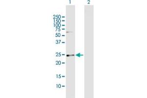 Western Blot analysis of CSN1S1 expression in transfected 293T cell line by CSN1S1 MaxPab polyclonal antibody. (Casein alpha S1 anticorps  (AA 1-185))