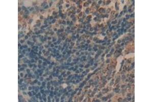 IHC-P analysis of Human Tissue, with DAB staining. (IL-21 anticorps  (AA 23-155))