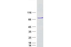 Validation with Western Blot