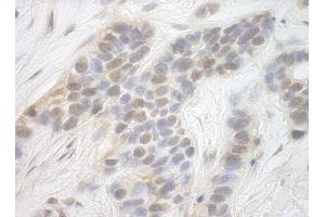 Immunohistochemistry (IHC) image for anti-Cyclin-Dependent Kinase 8 (CDK8) (AA 420-470) antibody (ABIN7448472)