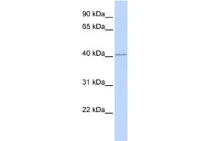 WB Suggested Anti-RING1 Antibody Titration:  0. (RING1 anticorps  (Middle Region))