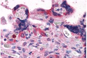 Human Placenta: Formalin-Fixed, Paraffin-Embedded (FFPE) (BAG3 anticorps  (AA 563-575))