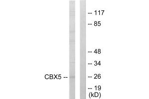Western blot analysis of extracts from HUVEC cells, using CBX5 antibody. (CBX5 anticorps  (Internal Region))