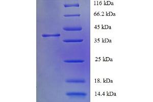 SDS-PAGE (SDS) image for Corticotropin Releasing Hormone Receptor 1 (CRHR1) (AA 24-121) protein (GST tag) (ABIN5709325)