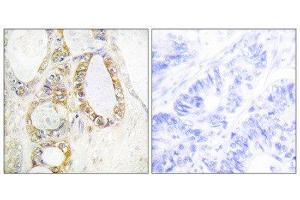 Immunohistochemistry (IHC) image for anti-Mucin 13, Cell Surface Associated (MUC13) (C-Term) antibody (ABIN1849970) (MUC13 anticorps  (C-Term))