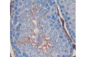 Used in DAB staining on fromalin fixed paraffin- embedded Kidney tissue