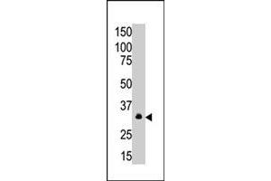 The MAGEA6 polyclonal antibody  is used in Western blot to detect MAGEA6 in A-549 cell lysate. (MAGEA6 anticorps  (C-Term))