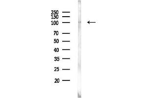 Western blot analysis of lysates from HUVEC cells, using USP13 Antibody at 1/1000 dilution.
