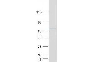 Validation with Western Blot