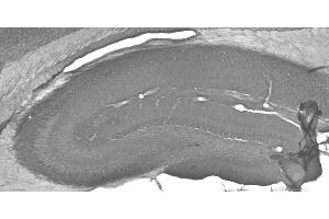 Adult rat hippocampus immunohistochemistry. (HSPA9 anticorps  (AA 551-766))