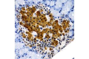 Immunohistochemistry of paraffin-embedded rat pancreas using MT2A antibody (ABIN1873764) at dilution of 1:200 (40x lens). (MT2A anticorps)