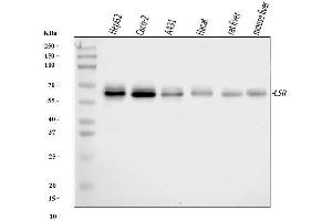 Western blot analysis of LSR using anti-LSR antibody .