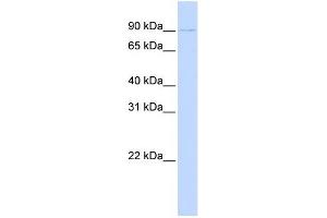WB Suggested Anti-PRDM13 Antibody Titration:  0. (PRDM13 anticorps  (N-Term))