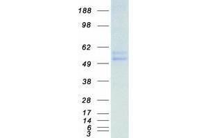 Validation with Western Blot